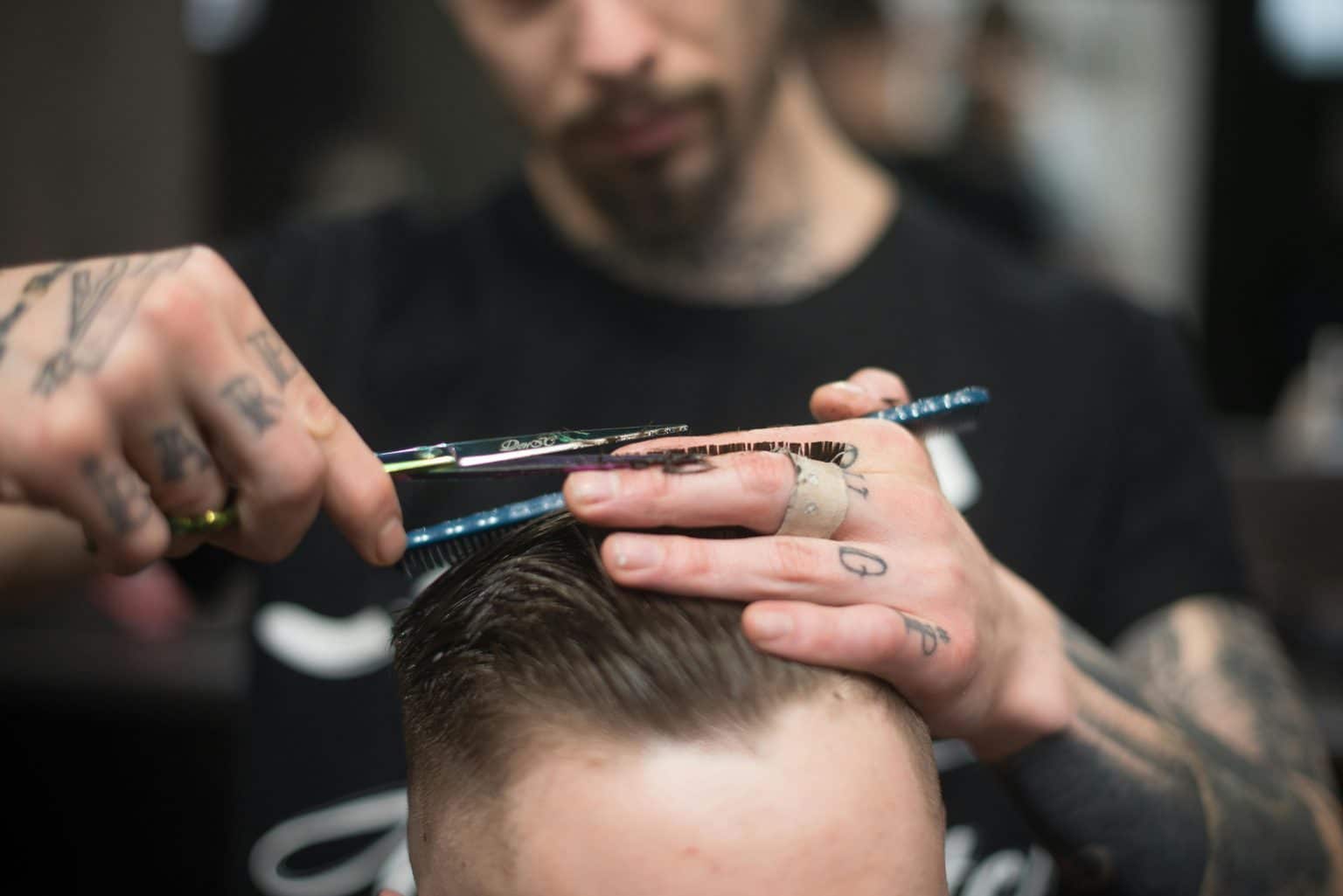 There is something fishy about your receding hairline, says hair expert